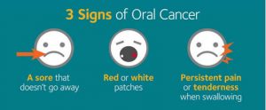 Oral Cancer